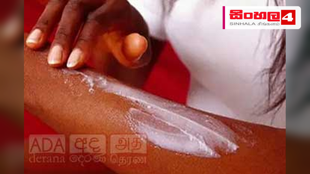චර්ම රෝග ව්යාප්තිය බරපතළ සෞඛ්ය ගැටලුවක්: වෛද්යවරු අනතුරු අඟවයි චර්ම රෝග ව්යාප්තිය බරපතළ සෞඛ්ය ගැටලුවක්: වෛද්යවරු අනතුරු අඟවයි